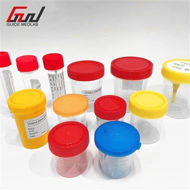 Nádobka na vzorky moču 250 ml